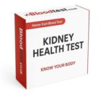 Kidney Blood Test Insights for Residents of Blackburn