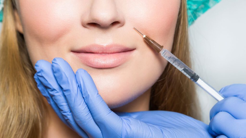 Lip Filler Simulation: Visualise Your Ideal Aesthetic!