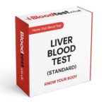 Liver Blood Test: Essential for Residents in Plymouth