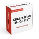 High Cholesterol Blood Test: Essential Guide for Bath Locals